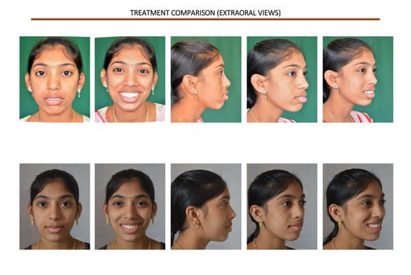 orthodontic4